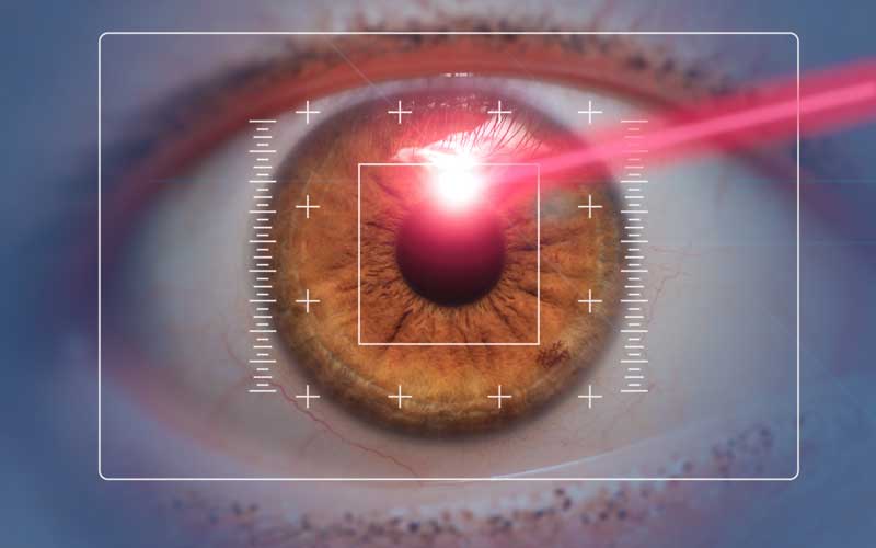 Lazer Göz Ameliyatı-Göz Çizdirme
